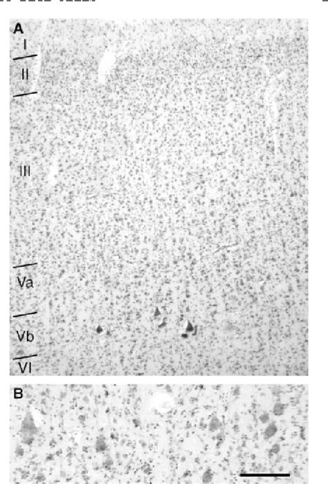 cells of betz|Stereologic characterization and spatial distribution .
